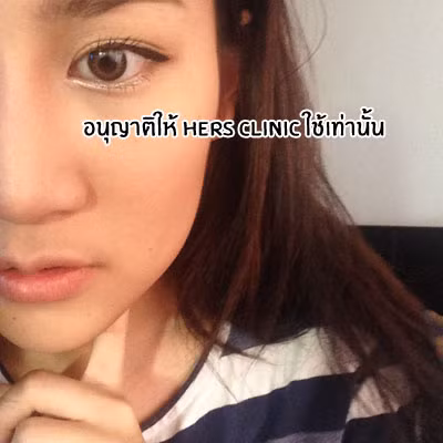 Tại đây, cô đã trình bày ý định muốn cắt bỏ phần mỡ thừa trên má để có được gương mặt thon gọn hơn thay vì phải phẫu thuật gọt hàm và độn cằm.