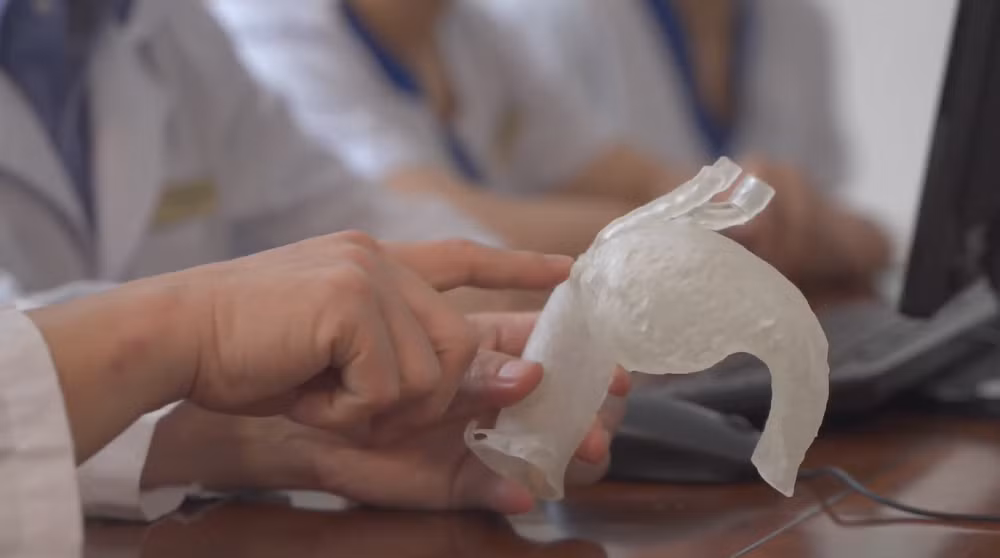 Vinmec áp dụng công nghệ 3D hỗ trợ can thiệp tim mạch lần đầu tiên ở Đông Nam Á - Hình 3 Vinmec ap dung cong nghe 3D ho tro can thiep tim mach lan dau tien o Dong Nam A-Hinh-3