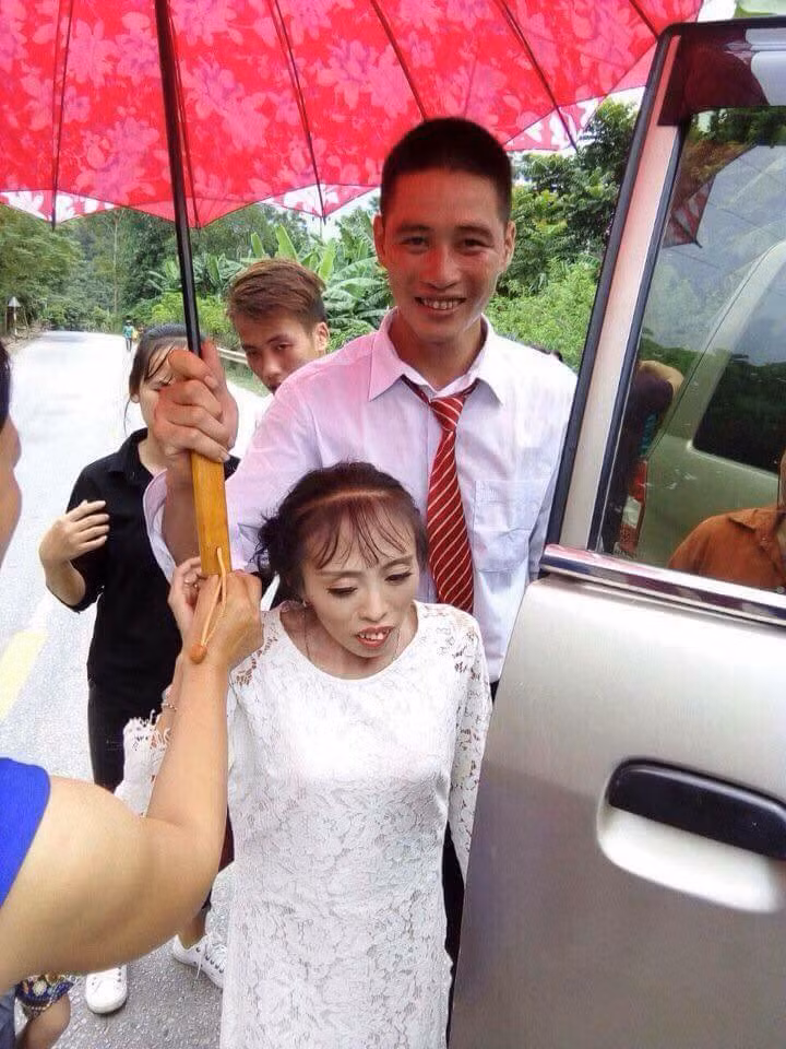Trong các bức hình nếu như chú rể có phần hình có phần tuấn tú, cao ráo thì cô dâu lại khá nhỏ bé và hơi có phần kém sắc hơn. Nhiều bình luận đã tỏ ra nghi ngờ mối tình của cặp đôi. Thậm chí, có ý kiến cho rằng, do gia đình của cô gái giàu có nên chàng trai này mới lấy cô.