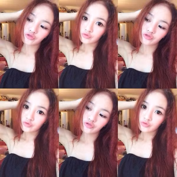 Gai tre suyt phai cat mui vi bien chung phau thuat tham my-Hinh-6