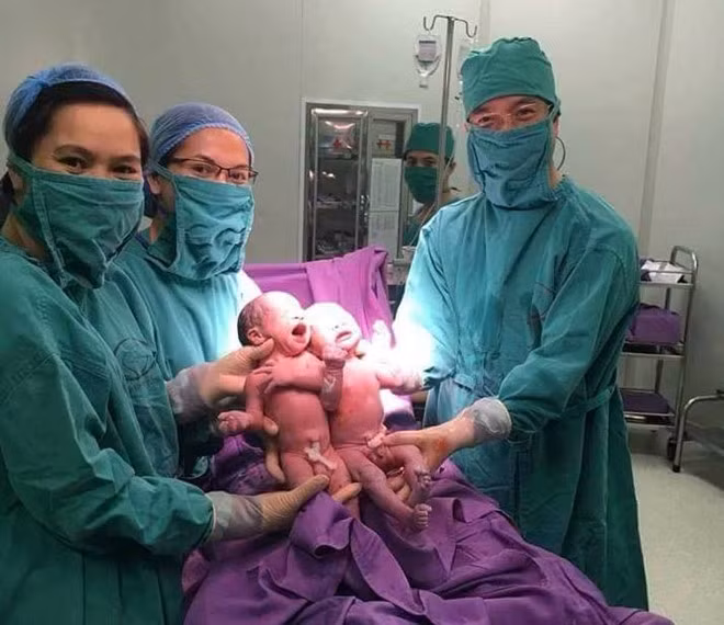 Hai bé trai sinh đôi cùng trứng nhờ phương pháp thụ tinh ống nghiệm IVF chào đời khỏe mạnh. Ảnh: BVCC