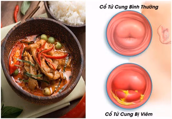 5 thuc pham 