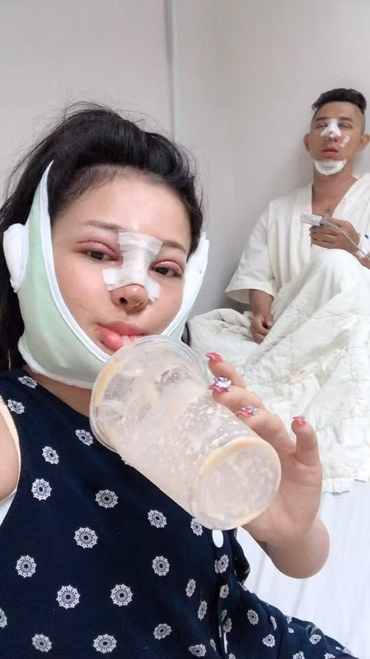 Trước khi công khai gương mặt sau "dao kéo", Lương Bằng Quang không ngại chia sẻ về quá trình phẫu thuật thẩm mỹ của mình và bạn gái tai tiếng Ngân 98. Cô nàng cũng được mệnh danh là hot girl nghiện "dao kéo".