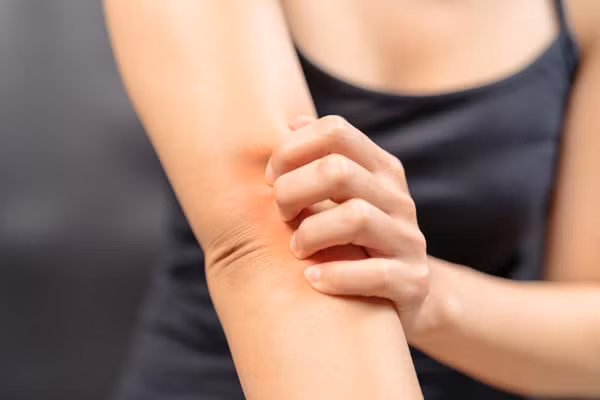 Mặt khác, lớp bọc nilon bên ngoài còn khiến mồ hôi, hơi nóng cơ thể khó không được thấm hút. Duy trì tình trạng trên lâu ngày sẽ khiến da bị tổn thương, kích ứng. Ảnh: IT