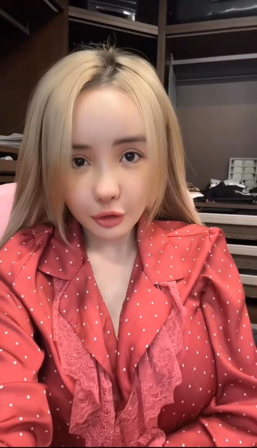 "Mấy đợt trước tôi cũng có nói đi thẩm mỹ muốn làm sao để nhìn mặt của tôi nét nào ra nét đấy, trông phải đứng tuổi và dữ lên tí xíu. Còn lần này, tôi đi sửa cho nó hiền lại." - Ngân 98 chia sẻ.
