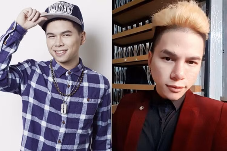 Chong mat voi ngoai hinh cac sao nam dinh on ao dao keo