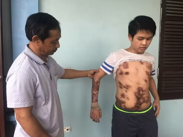 Tiến Anh may mắn sống sót sau vụ hỏa hoạn khiến 8 người tử vong.