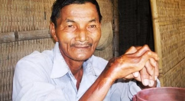Thái Ngọc - Người đàn ông 45 năm chưa từng chợp mắt Chẳng cần đến cà phê, người đàn ông này đã thức suốt 45 năm. Ông “Hai Ngọc”, 76 tuổi (ông tên thật là Thái Ngọc ở xã Quế Trung, huyện Nông Sơn, tỉnh Quảng Nam) mắc chứng mất ngủ trầm trọng từ năm 1973. Điều kỳ ở đây là tuy không ngủ nhưng tinh thần ông Ngọc vẫn vô cùng tỉnh táo và khỏe mạnh, ông vẫn có thể làm việc mỗi ngày, thậm chí là việc nặng nhọc.