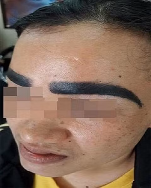 Seo loi, lom nhu “o trau, o ga” tren mat vi thich xam vo toi va