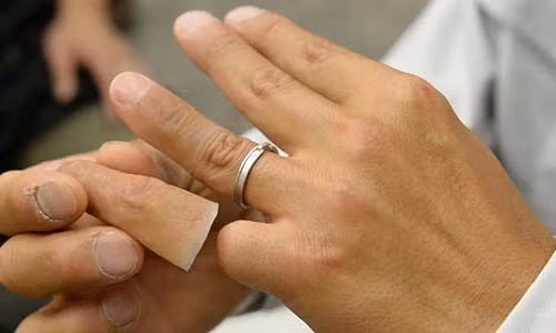 Một thành viên băng đảng tội phạm Nhật đeo ngón tay giả.