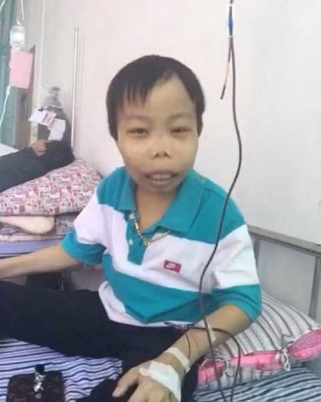 Thời điểm đó, Trần Sơn lên tiếng phù nhận và đáp trả cực gay gắt: "Hỡi những kẻ cho rằng tôi đang dựng chuyện ồn ào trên mạng, hãy câm miệng. Tôi bị bệnh thiếu máu Địa Trung Hải (còn gọi là hội chứng thalassemia). Vài ngày tôi lại phải truyền máu một lần. Lúc trước, bác sỹ nói tôi khó có thể sống đến lúc trưởng thành, nhưng tôi vẫn sống tốt cho tới nay. Tôi không cần sự đồng tình của các người. Tôi chỉ muốn mọi người vui vẻ. Tôi biết tôi rất xấu xí".