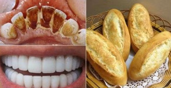 Bạn có thể lấy cao răng tại nhà chỉ bằng cách sử dụng bánh mỳ.