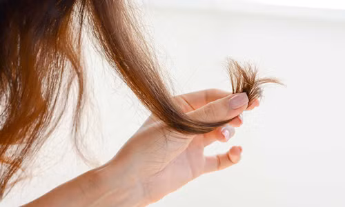 Màu sắc của tóc người là do sắc tố melanin quyết định. Ảnh: Istock. Màu sắc của tóc người là do sắc tố melanin quyết định. Ảnh: Istock.