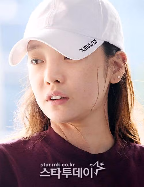 Nữ ca sĩ tới đồn cảnh sát với gương mặt nhiều vết thương.