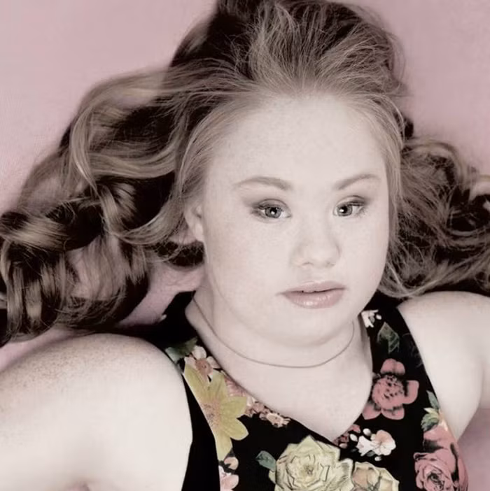 Madeline Stuart, 18 tuổi hiện là một người mẫu xinh đẹp. Cô bị bệnh down bẩm sinh nhưng vẫn lấn sân vào thế giới người mẫu và muốn xã hội thừa nhận rằng, bất cứ ai cũng có thể thực hiện ước mơ của mình miễn là bạn quyết tâm. Cô đã làm thay đổi nhận thức về chuẩn mực cái đẹp.