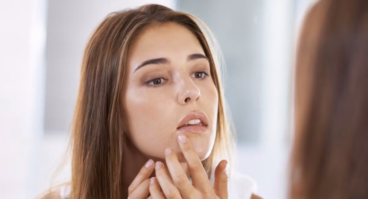 Rửa mặt với nước ấm là lựa chọn tốt nhất cho các chị em khi da nổi nhiều mụn trứng cá. (Nguồn Acne)