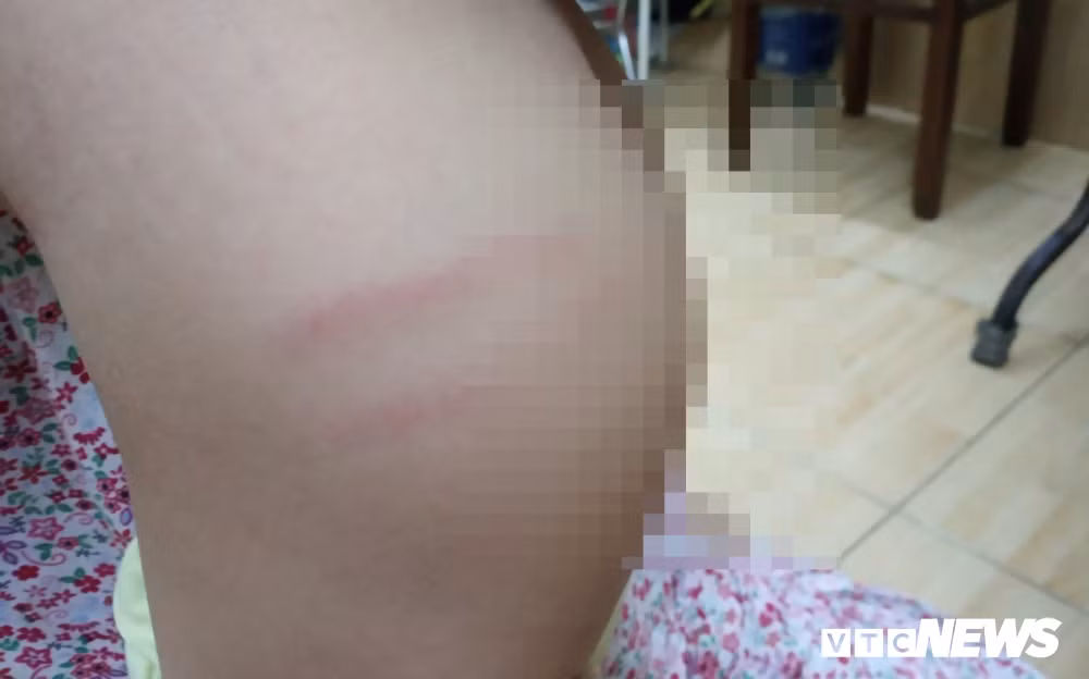 Truong mam non o Da Nang bi to danh, bo doi tre nhieu ngay