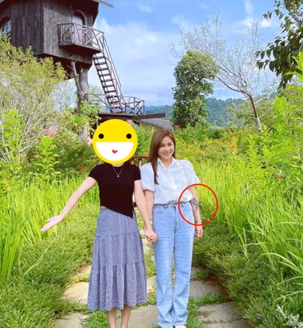 Cư dân mạng tỏ ra khá khó hiểu, tò mò về sự có mặt của "vết loang lổ" trên cánh tay cựu MC Chúng Tôi Là Chiến Sĩ.
