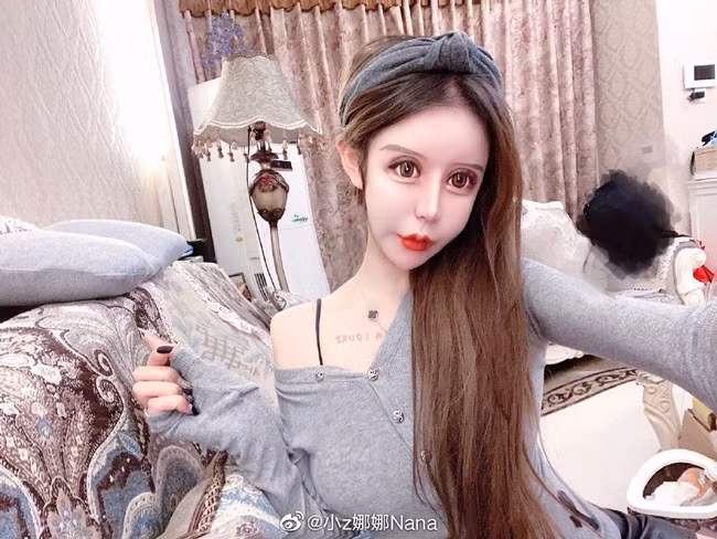 Từ một cô gái sở hữu nhan sắc bình thường, Tiểu Z Na Na tự biến mình thành thảm họa thẩm mỹ sau những cuộc đại phẫu.
