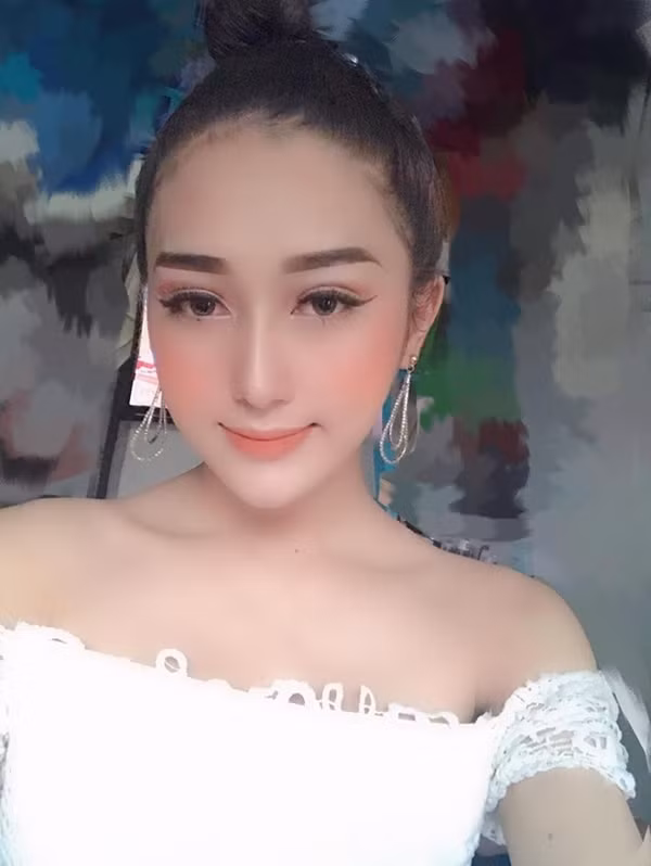 Được biết, để sở hữu diện mạo hiện tại, cô gái tên An Kim, quê Cà Mau, hiện đang sinh sống tại TP HCM đã trải qua 2 năm chịu đau đớn, những lần phẫu thuật thẩm mỹ lớn nhỏ.