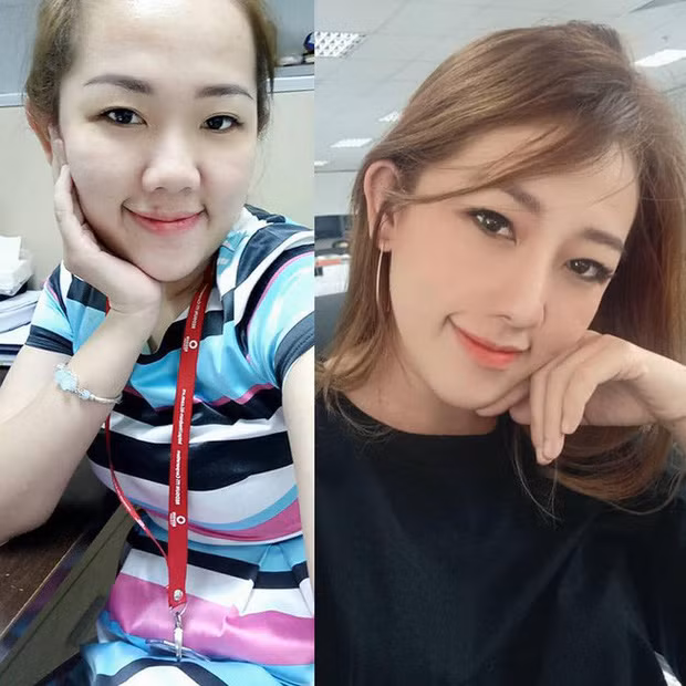 Chi sua mot diem tren mat, gai xinh thay doi cuoc song chong mat