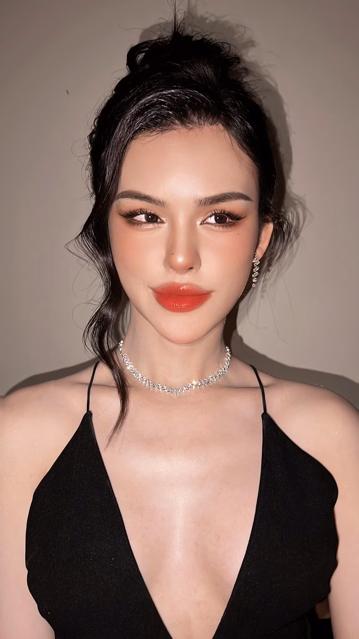Lúc mới phẫu thuật xong nhan sắc của Trần Đức Bo có phần còn hơi đơ cứng, tuy nhiên sau 1 thời gian các đường nét trên gương mặt đã mềm mại hơn.