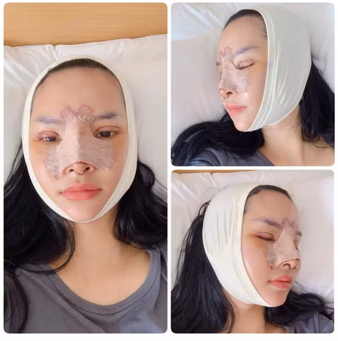 Chị Hạnh chia sẻ, khoảng thời gian đó chỉ ước mơ như vậy chứ biết khi nào mới giàu, vài trăm triệu để tân trang nhan sắc là con số không hề nhỏ. Đặc biệt là chị chỉ ở nhà chăm con và tiêu tiền của chồng thì ước mơ gần như là không thể thực hiện được.