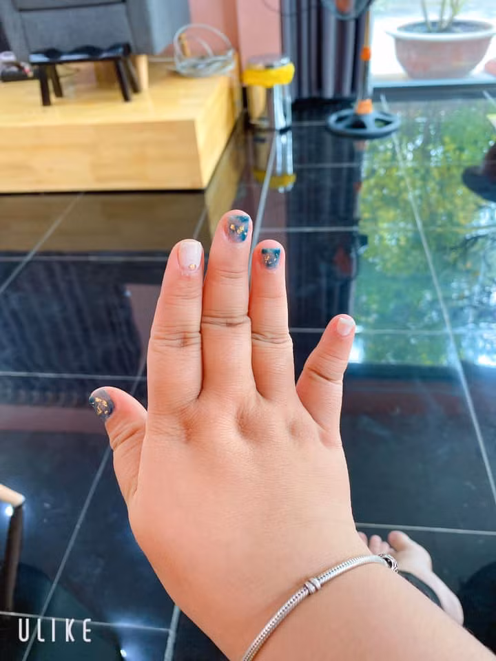 Làm nail ngày Tết chính là một việc không thể thiếu đối với phụ nữ. Thế nhưng kết quả đôi khi khiến hội chị em phải dở khóc dở cười. Lỗi đa phần thuộc về tiệm nail, nhưng cũng đôi lúc thuộc về bản thân khách hàng. Ví dụ như sở hữu bàn tay mũm mĩm thế này thì có trời cứu, thợ nail giỏi đến đâu cũng bất lực.