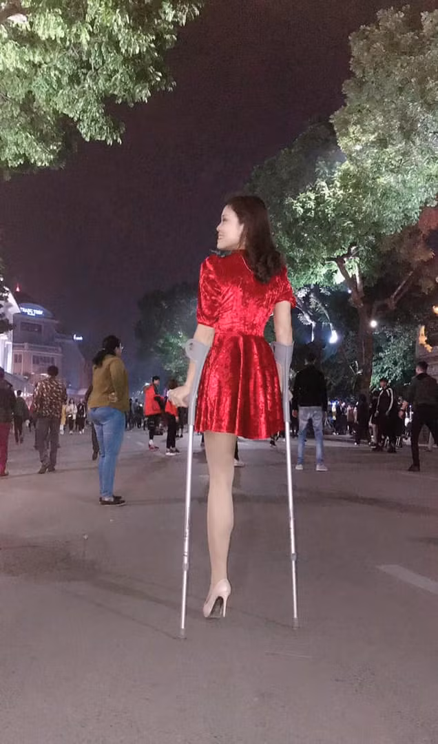 Mới đây, nhiều fanpage lớn trên mạng xã hội chia sẻ thông tin về cô gái cụt một chân đầy nghị lực, luôn lạc quan và yêu đời thu hút sự chú ý của cộng đồng.