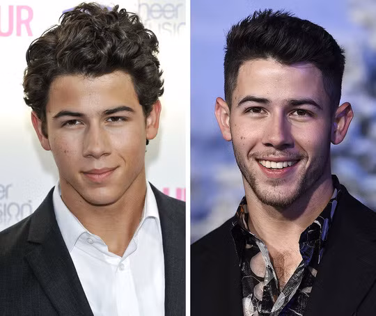 Nick Jonas của hiện tại vẫn điển trai giống như 10 năm trước của nam ngôi sao Hollywood nhưng vẻ đẹp của anh đã trở nên phong trần, nam tính hơn so với hình ảnh dễ thương trước đây.