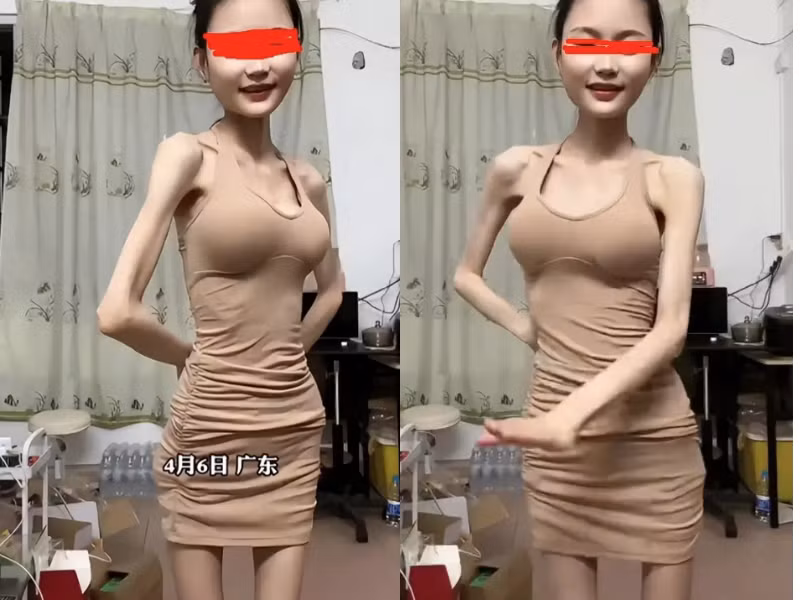 Rất nhiều người dùng mạng bày tỏ ý kiến cho rằng, việc thân hình quá mức “cò hương” như cô gái khiến người xem phải lo ngại và không hề đẹp chút nào: "Cứ như bộ xương di động vậy, không biết đẹp chỗ nào", "như này là giảm cân cực đoan quá rồi, dễ gặp phải vấn đề về sức khỏe lắm".