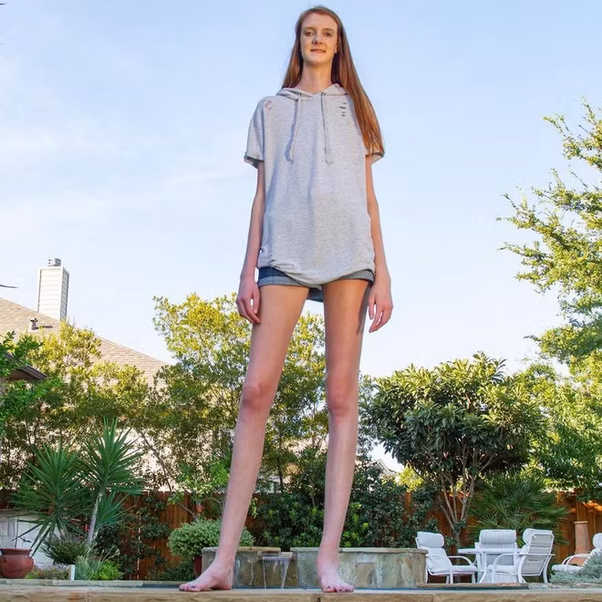 Maci Currin (sinh năm 2003, đến từ Texas, Mỹ) sở hữu chiều cao vượt trội 2,1 m khi mới 16 tuổi. Đặc biệt, đôi chân dài nhất thế giới của cô dài tới 1,34 m - hơn 2 cm so với kỷ lục Guinness thế giới do Ekaterina Lisina nắm giữ từ năm 2017. Lúc mới sinh, Maci cao chưa đến 50 cm. Trong quá trình lớn lên, chiều cao của 10X phát triển chóng mặt. Mới 9 tuổi, cô đã cao 1,7 m.