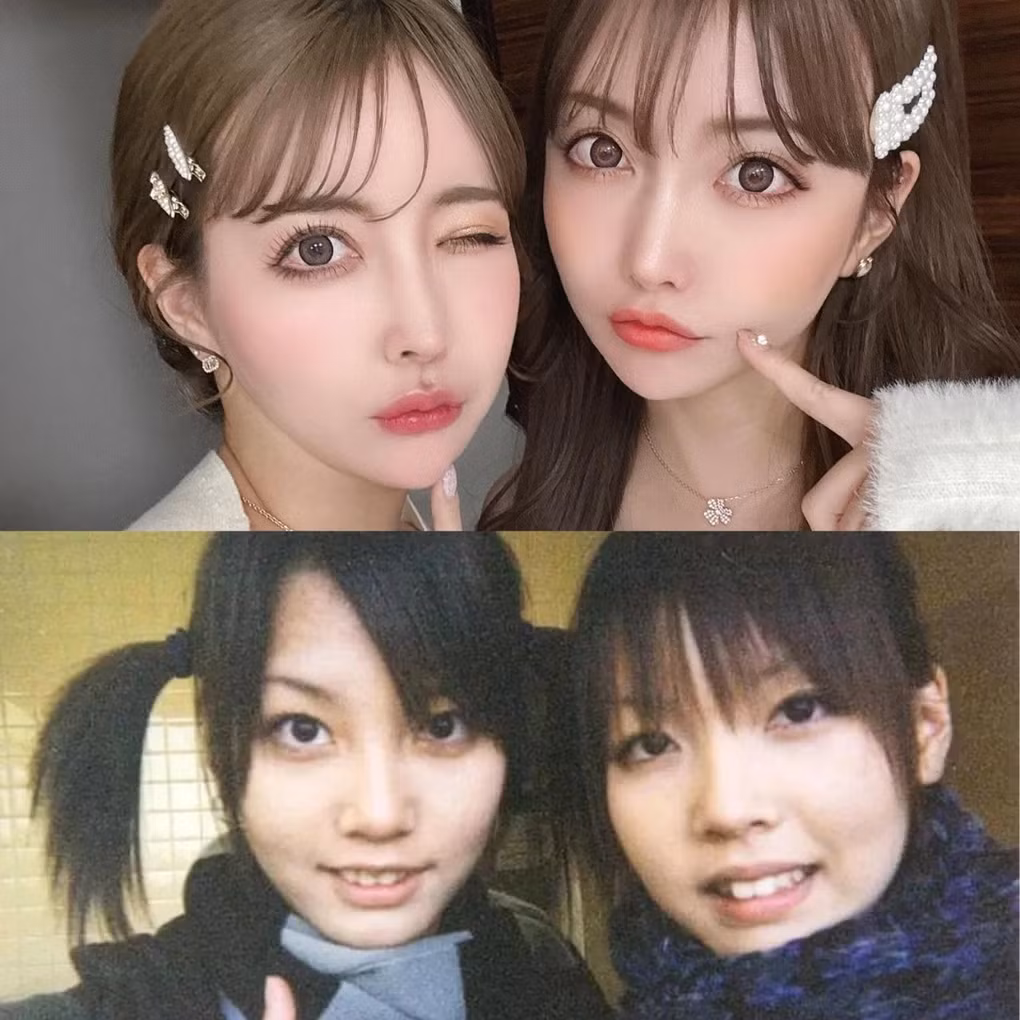 Hai cô nàng được cho là gương mặt đã có sẵn những đường nét thanh tú. Tuy nhiên, ngay từ khi còn nhỏ, hai chị em đã có ám ảnh về việc phải thay đổi ngoại hình. Sau mỗi lần nhan sắc bị so sánh với nhau, họ lại đứng trước gương và tìm kiếm những khuyết điểm trên gương mặt.