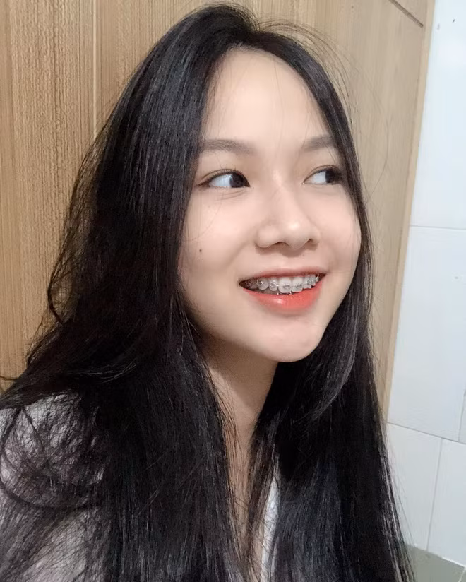 So sánh ảnh ngày ấy - bây giờ của Phương Quỳnh, nhiều người khen ngợi nhan sắc cô ngày càng tươi tắn, thu hút.