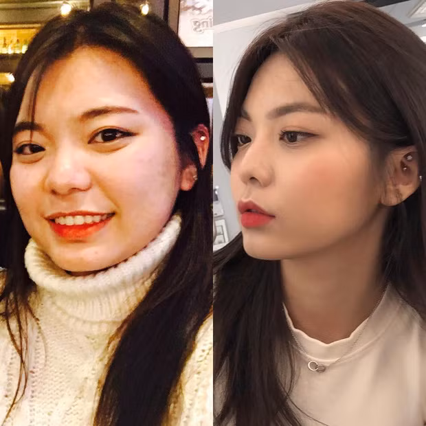 Khuôn mặt của hot girl giảm cân Seungjin cũng trở nên thon gọn, xinh đẹp hơn.