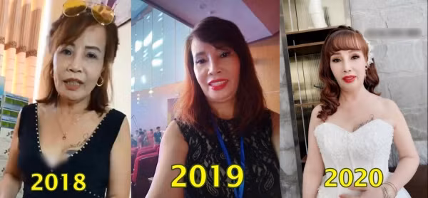 Từ khi lấy chồng trẻ 26 tuổi vào năm 2018, sau hai năm trở thành vợ người ta, cô Thu Sao đã trải qua đến 4-5 lần tân trang khuôn mặt để có được nhan sắc như hiện tại.