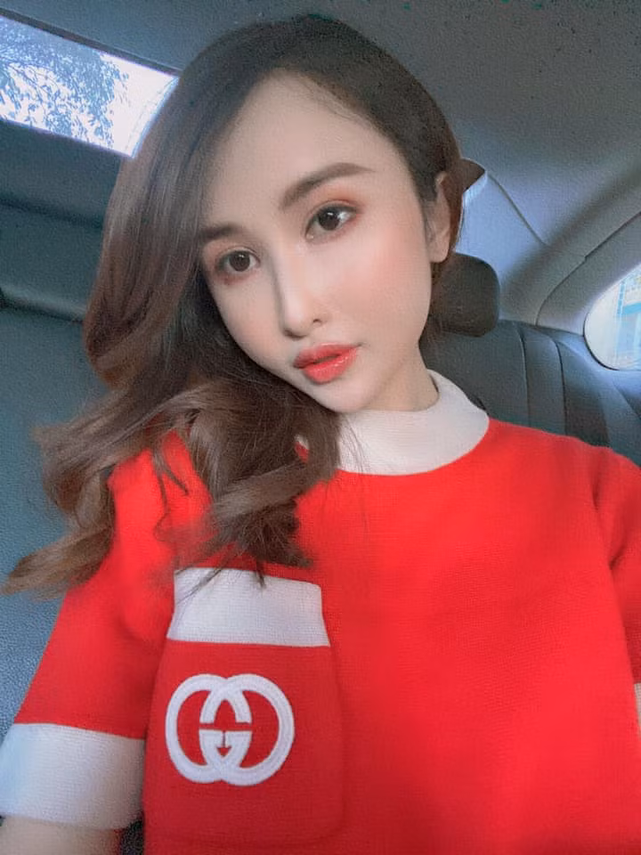 Cằm quá nhọn cũng khiến khuôn mặt mất cân đối.