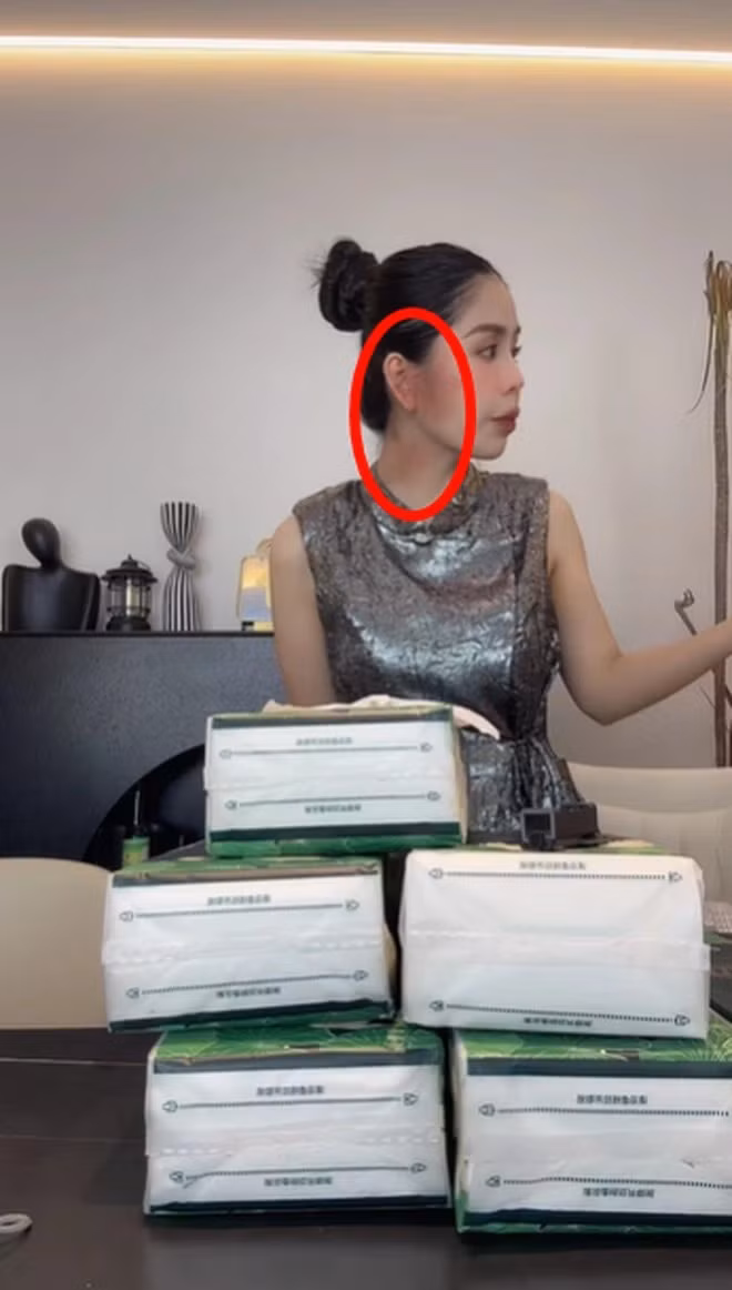 Cách đây ít ngày, Hằng Du Mục xuất hiện trên live trong tình trạng mặt và tay có những vết bầm lớn khiến netizen lo lắng. Chồng của cô cùng đã thừa nhận cả 2 có sự xô xát.