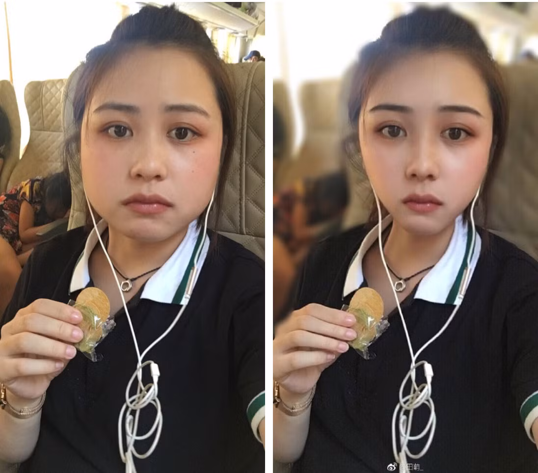 Mọi khuyết điểm khó khắc phục trên khuôn mặt như hàm to, sống mũi thấp đều cực kỳ dễ cải thiện. Nếu can thiệp có thể mất đến nửa năm để hồi phục mà lại đau đớn, tốn kém, vậy thì tội gì không chọn cách dễ mà làm?