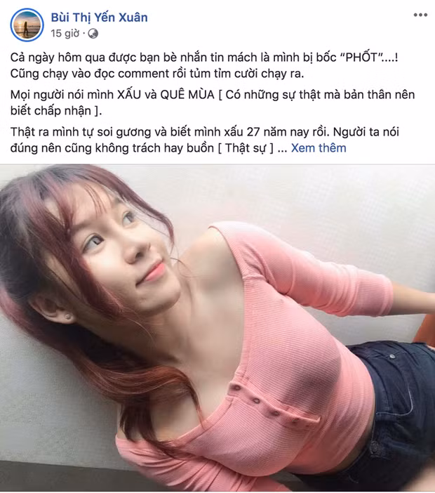 Trước đó, Yến Xuân từng bị dân mạng chê là quê mùa và kém xinh. Không những không phản pháo, cô nàng thẳng thắn thừa nhận vì sinh ra ở quê nên cô trông còn "phèn" và kém xinh.