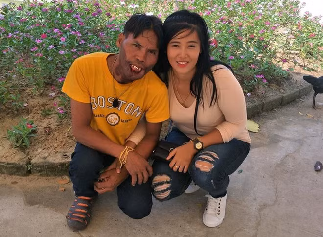 Năm 2018, đám cưới của cặp đôi Patras Raknak và Boonmee Khantong ở Changwat Songkhla (Thái Lan) thu hút sự chú ý của dân mạng châu Á. Bởi trong khi Raknak sinh năm 1995, có ngoại hình ưa nhìn, thì Khantong lại kém sắc, bị dị tật ở môi và hơn vợ 11 tuổi. Trước mối tình này, Raknak có 1 đời chồng và con gái nhỏ. 9X nhận xét dù Khantong khiếm khuyết về ngoại hình, anh rất hiền lành, chịu khó và chăm lo cho 2 mẹ con cô.