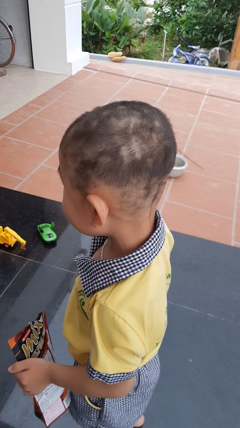 "Khổ thân, sau này lớn mà nhìn thấy ảnh này chắc nó khóc thét luôn chứ chả vừa, không ngờ ngày xưa bị bố mang ra thử nghiệm tay nghề", "Ai không biết lại tưởng bị nấm da đầu, đến khổ với ông bố" - Dân mạng hài hước bình luận.
