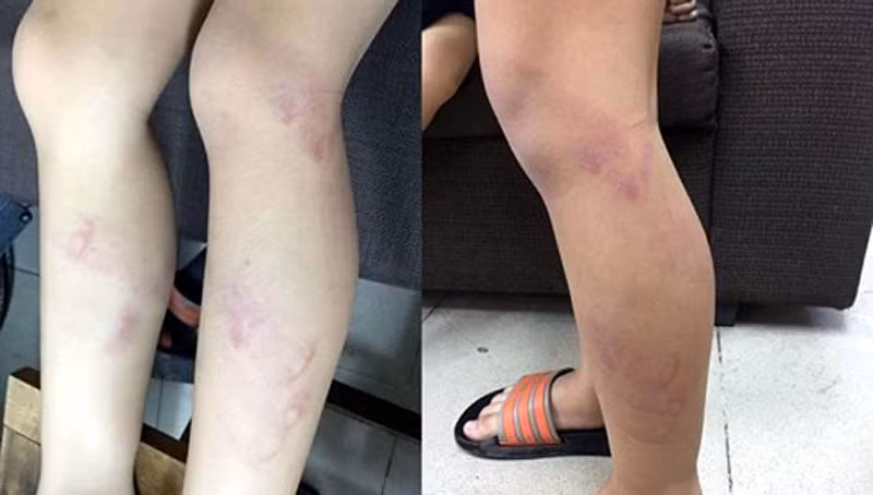 HN: Co giao dung thuoc danh tim chan hoc sinh nhan ky luat
