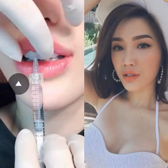 Người đẹp luôn cứng rắn đáp trả lại mọi bằng chứng liên quan đến việc phẫu thuật thẩm mỹ. (Ảnh FB, thẩm mỹ viện...)