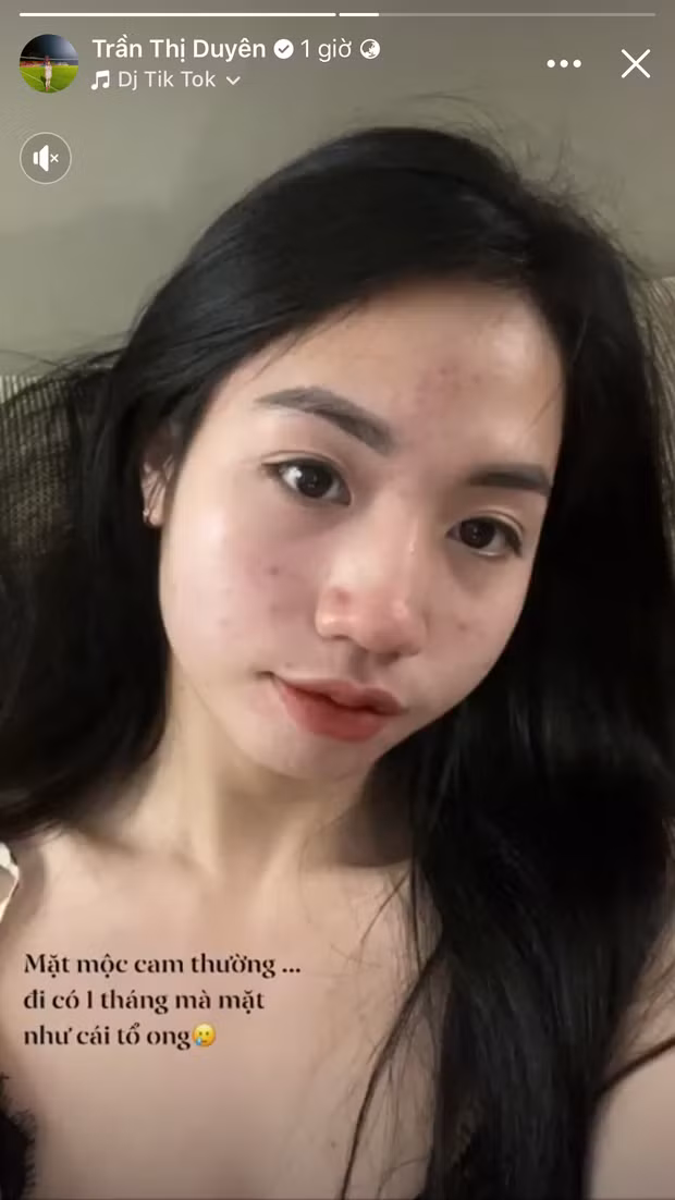 Tuy nhiên mới đây, hot girl bóng đá đã tự đăng ảnh chính mình với gương mặt mộc, chụp bằng cam thường, da mặt không ít mụn khiến netizen bất ngờ.