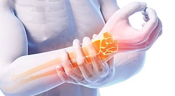 Khi bị đau dây thần kinh dạng này, hãy theo dõi chặt chẽ lượng đường trong máu và điều trị tích cực, bác sĩ chuyên khoa sẽ phối hợp điều trị với những khoa khác để kiểm soát tiến triển của bệnh này để làm thuyên giảm dần tình trạng bệnh.