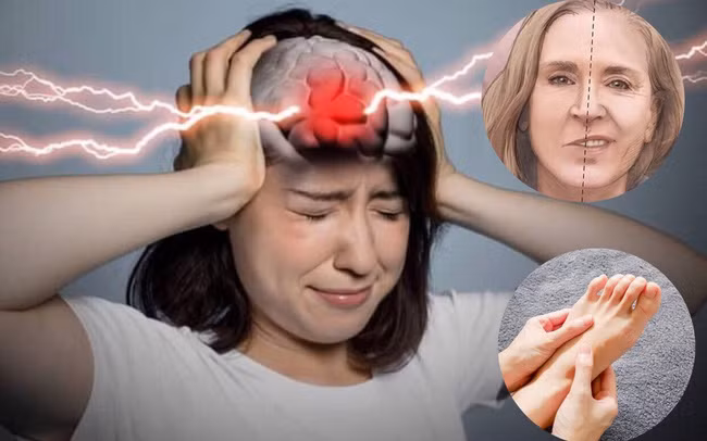 Cô Hoàng Ngọc, người Trung Quốc, là một giáo viên cấp 2. Không ai nghĩ rằng cô đã ngã gục trên bục giảng yêu thích của mình ngay sau sinh nhật lần thứ 40 và không bao giờ tỉnh dậy nữa, tất cả vì bị chứng nhồi máu não đột ngột. (Ảnh minh họa)