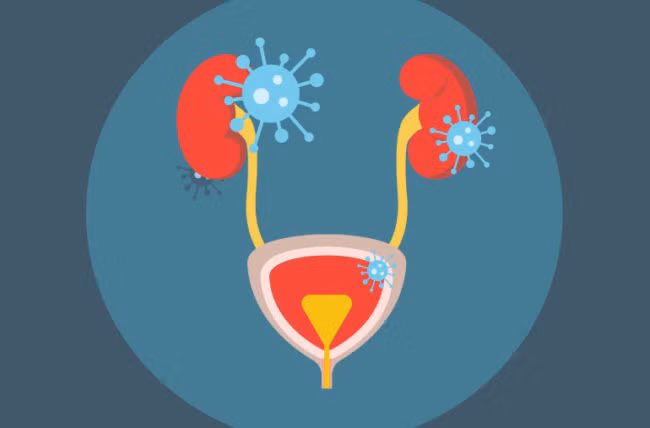 Nguyên nhân phổ biến nhất của bệnh là do vi khuẩn Escherichia coli. Tuy nhiên, các loại vi khuẩn hay các loài nấm khác cũng có thể là "thủ phạm". Ảnh: HC.