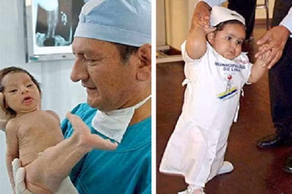 Thực hư về bệnh lạ "nàng tiên cá" và cơ hội sống sót - Hình 3 Thuc hu ve benh la