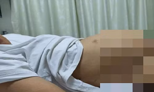 Nữ sinh tưởng mình có dáng đẹp, nào ngờ mắc bệnh hiểm Nu sinh tuong minh co dang dep, nao ngo mac benh hiem